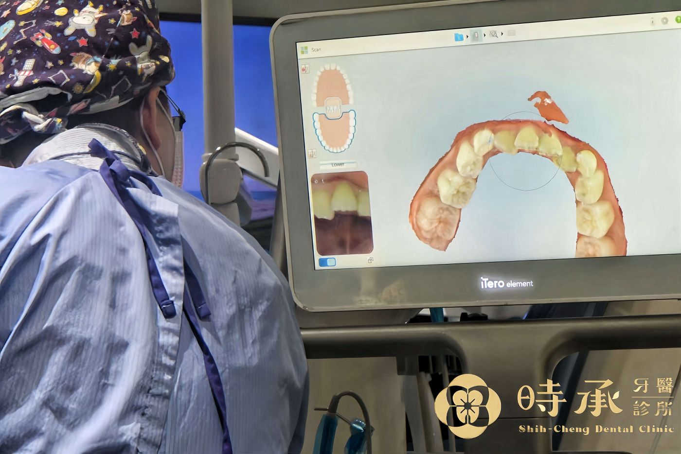 隱適美矯正流程一次搞懂